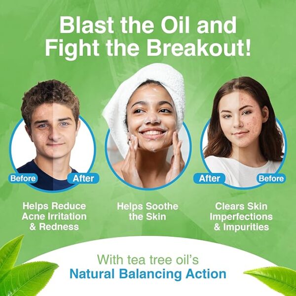 Kidskin T-Blast Facial Cleanser, Gentle Face Wash with Tea Tree Oil, Spot Skin Care for Kids and Teens, Non-Drying Natural Cleanser for Oily or Dry, Acne-Prone Skin, 150 ml 5.0 fl oz. - Image 5