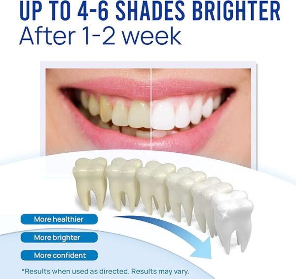 VieBeauti Teeth Whitening Pen (3 Pcs), 30+ Uses, Effective, Painless, No Sensitivity, Travel-Friendly, Easy to Use, Beautiful White Smile, Mint Flavor - Image 8