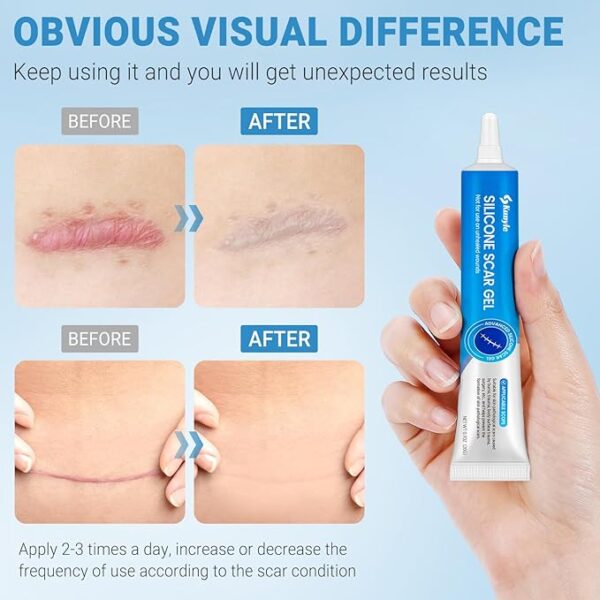 Silicone Scar Gel, Scar Cream, Advanced Scar Gel for Surgical Scars, Stretch Marks, Keloid Bump Removal, Old and New Scars 0.70oz (20g) - Image 4